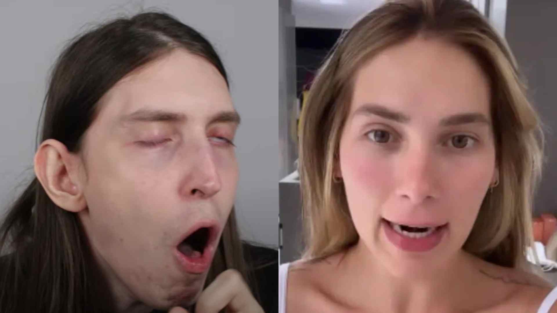 Influenciador Felca vomita ao usar produto de Virginia Fonseca: “Terrível”