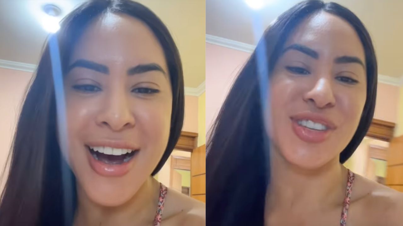 Isabelle Nogueira mostra hematomas depois de participação no festival de Parintins
