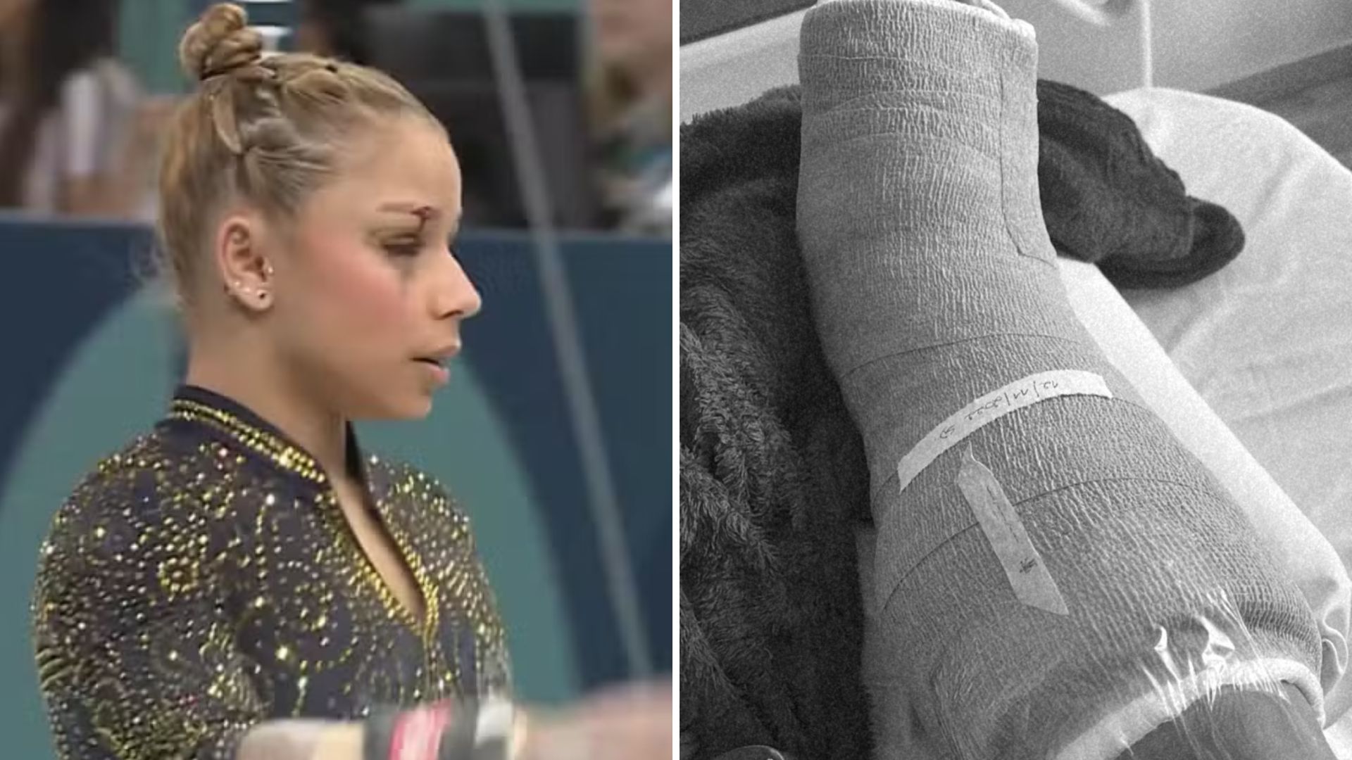 Lesionada nas Olimpíadas, Flávia Saraiva passou por cirurgia tensa antes de Paris
