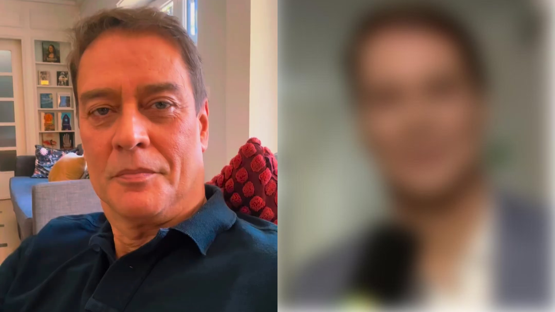 Marcello Antony surpreende ao expor antes e depois de harmonização: “Gostei bastante”