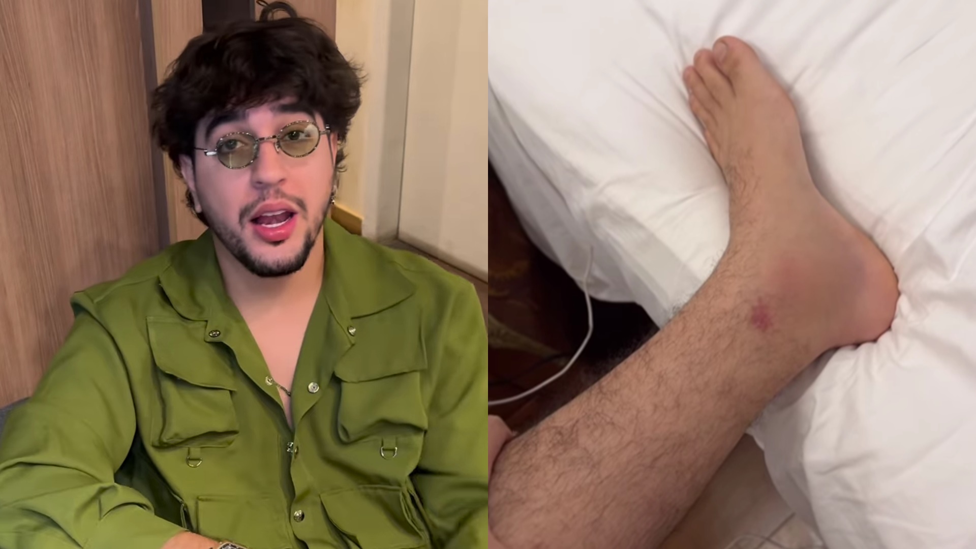 Nattanzinho exibe inchaço após ser atacado durante show: “Não dá pra ver o osso”