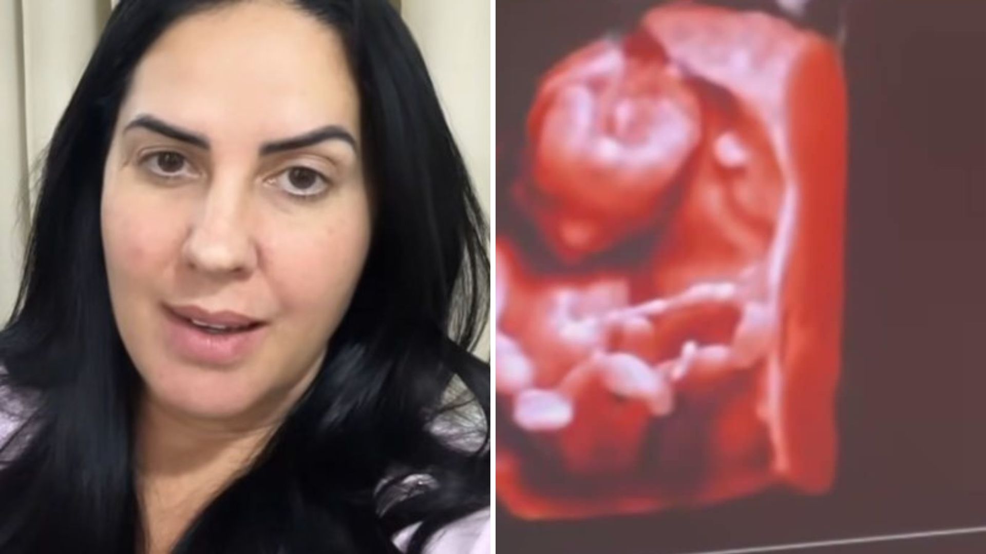 São dois? Graciele Lacerda mostra ultrassom pela primeira vez: “Não para de se mexer”