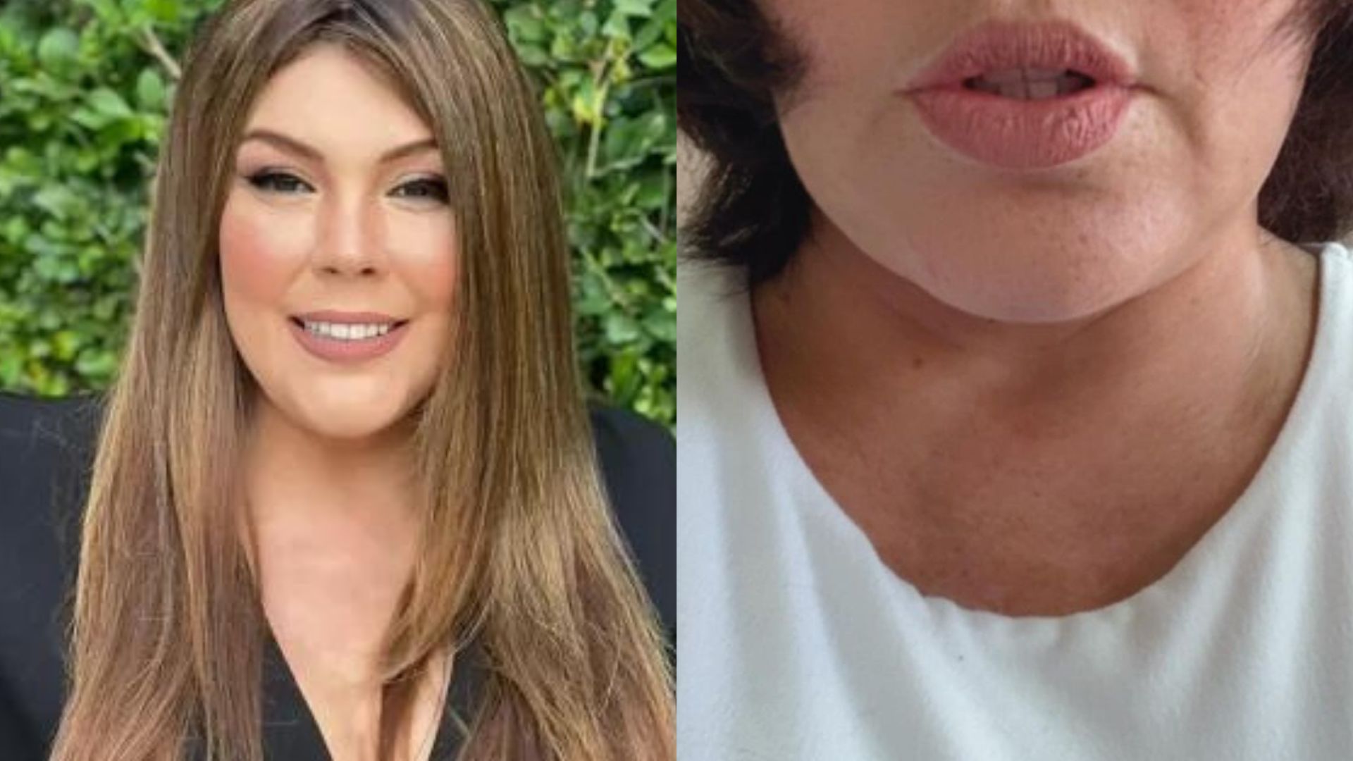 Simony surpreende ao mostrar cabelo natural após sessões de quimioterapia