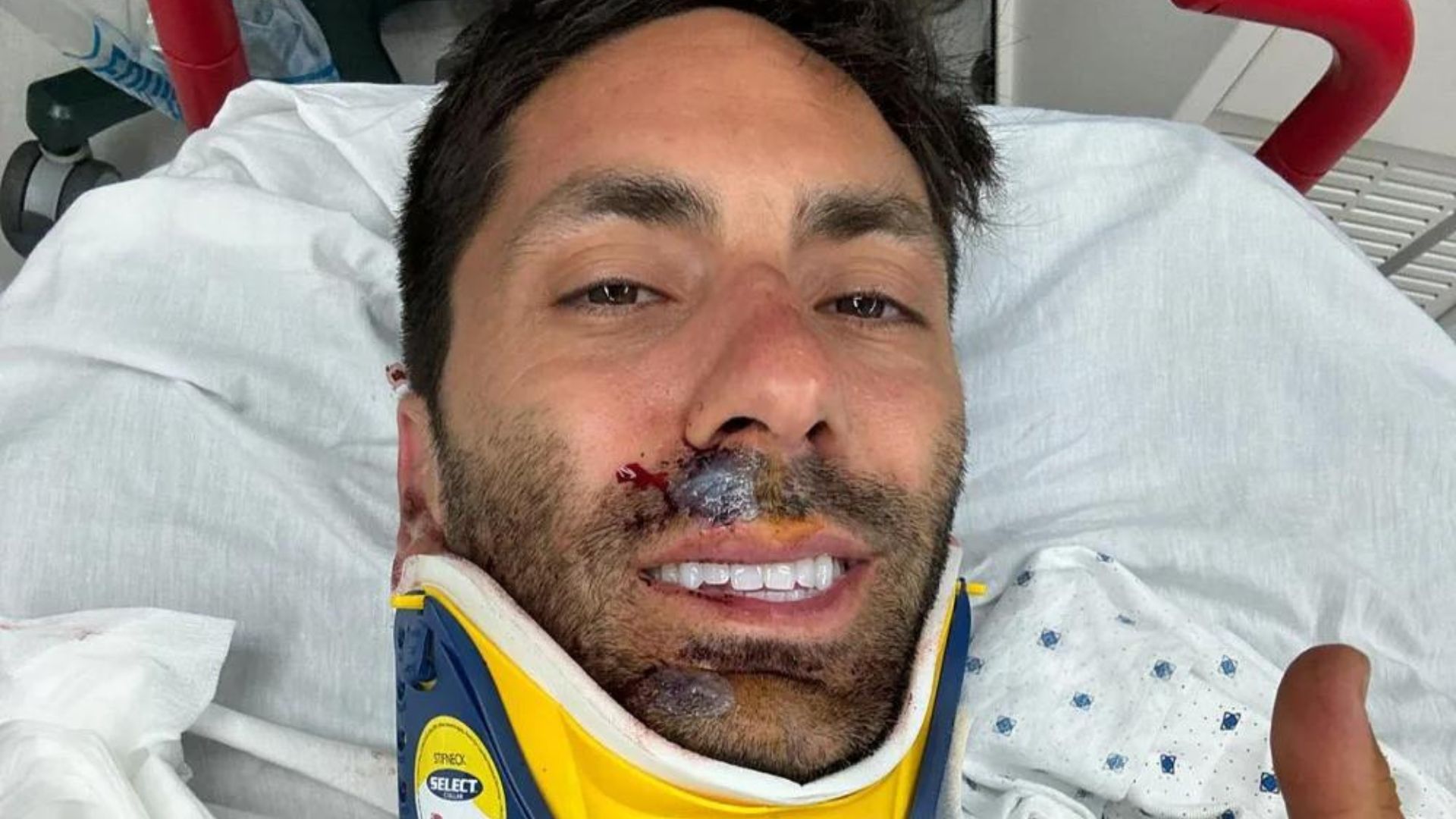 Apresentador sofre acidente e quebra o pescoço ao bater em caminhão: “Sorte de estar vivo”