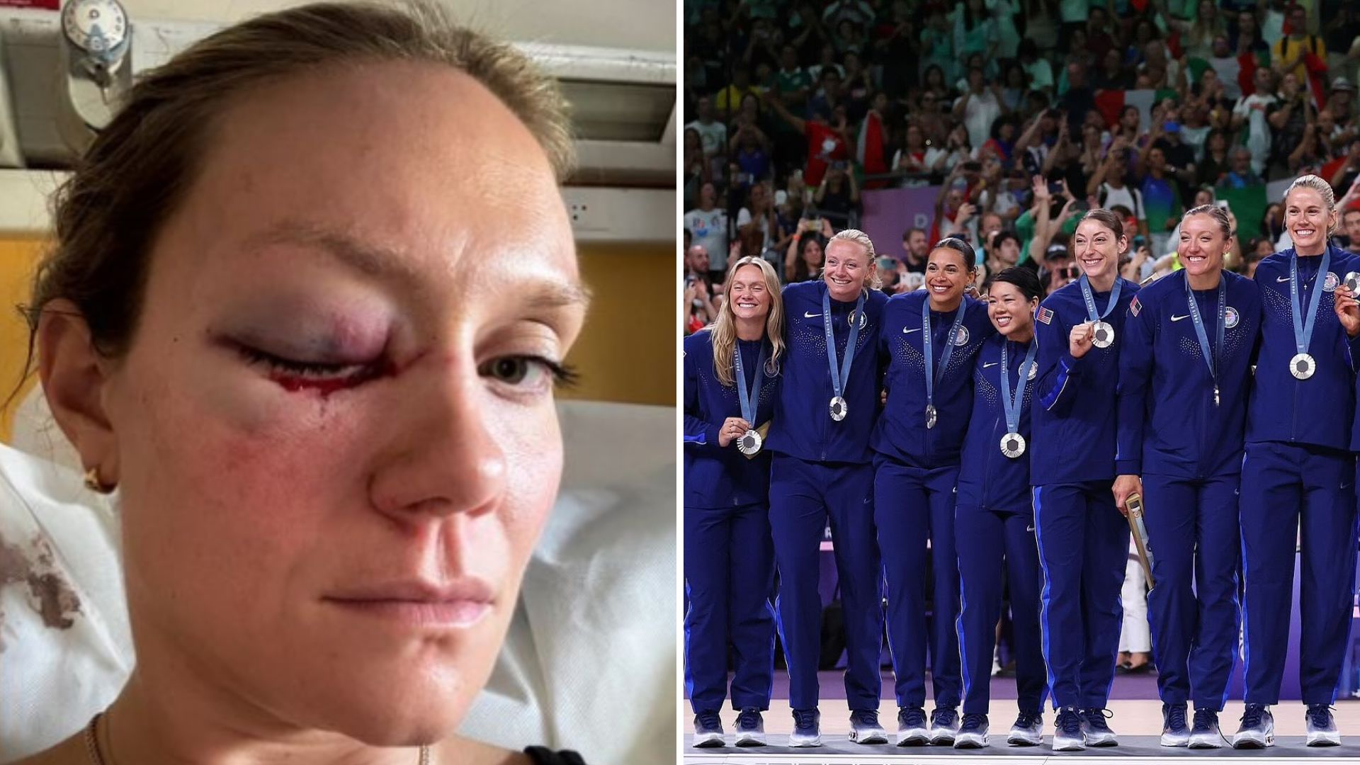 Medalhistas das Olimpíadas de Paris sofrem acidente após celebração: veja o que aconteceu