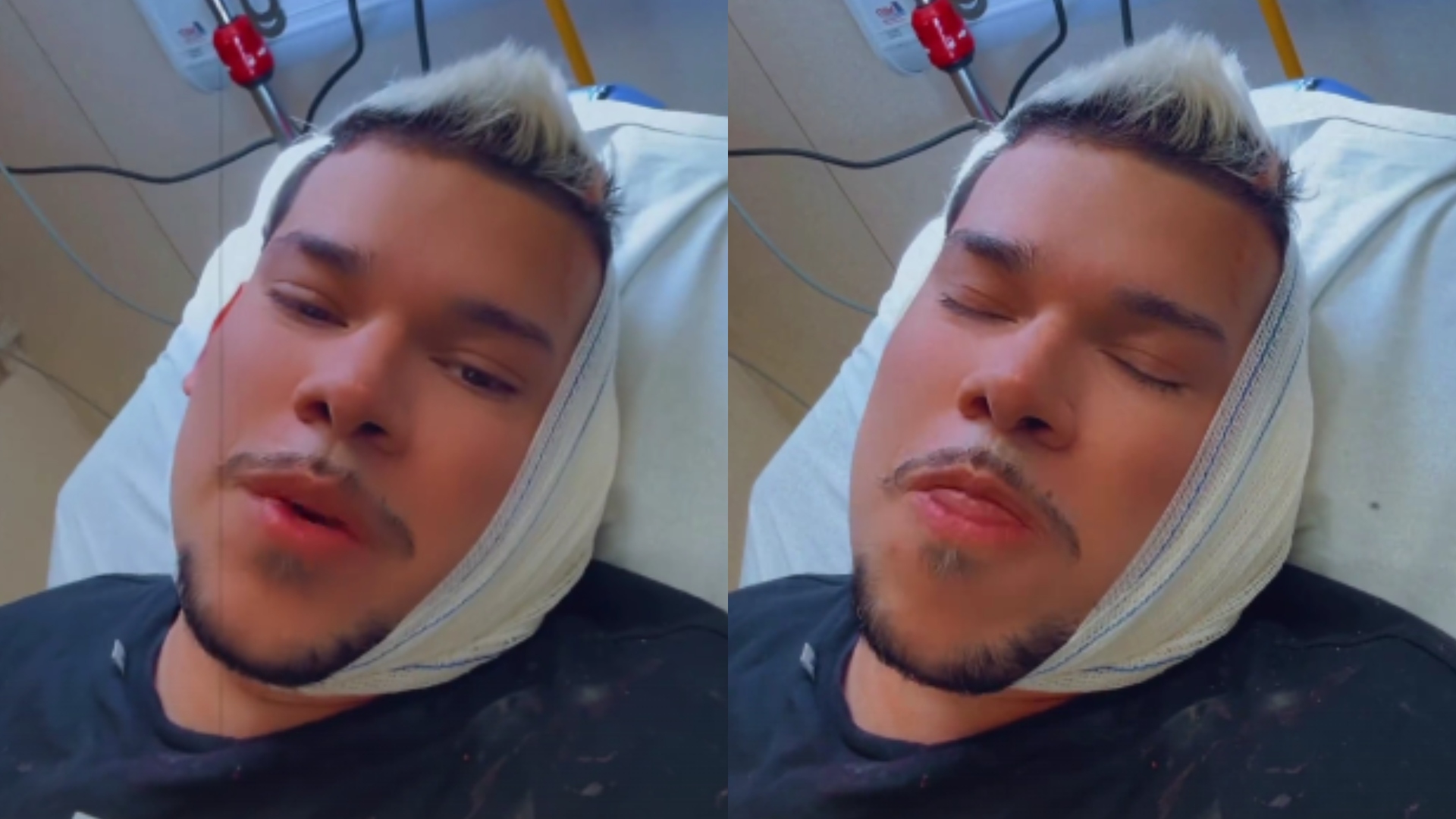 DJ Buarque perde parte da orelha em acidente e é hospitalizado às pressas: “Dor”