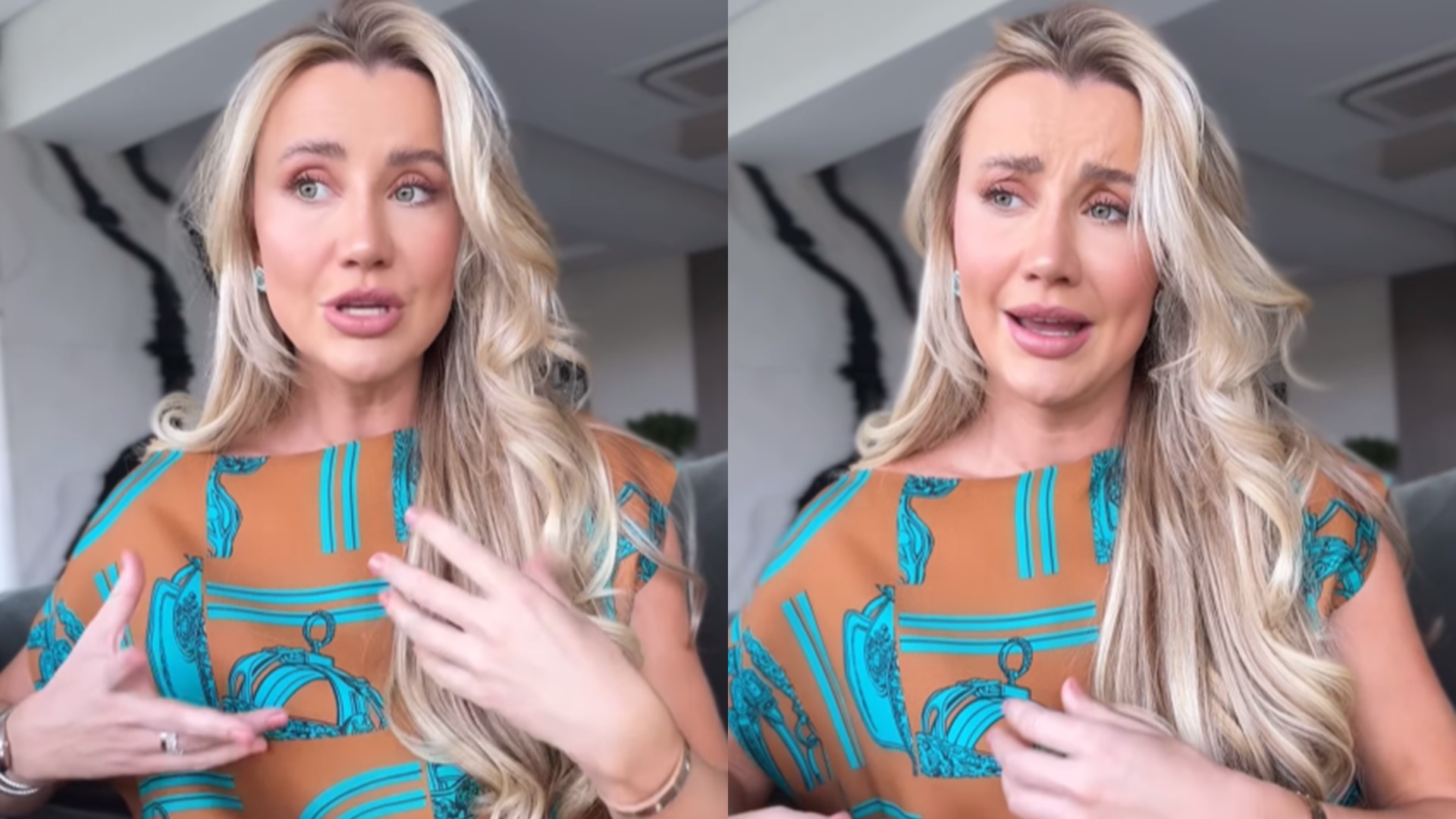 Ana Paula Siebert desabafa após internação às pressas e cirurgia rara: “0.3% de chance”