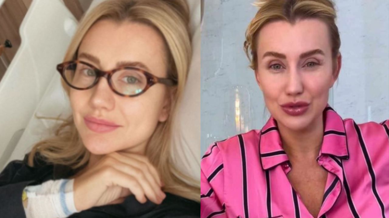 Ana Paula Siebert detalha recuperação de cirurgia: “Inchaço piorou”
