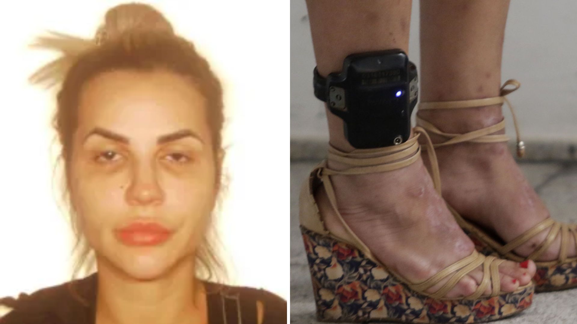 Em prisão domiciliar, Deolane Bezerra é obrigada a usar tornozeleira eletrônica