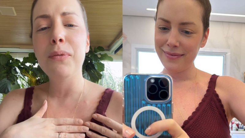 Fabiana Justus celebra evolução e encerra ciclo no tratamento contra o câncer