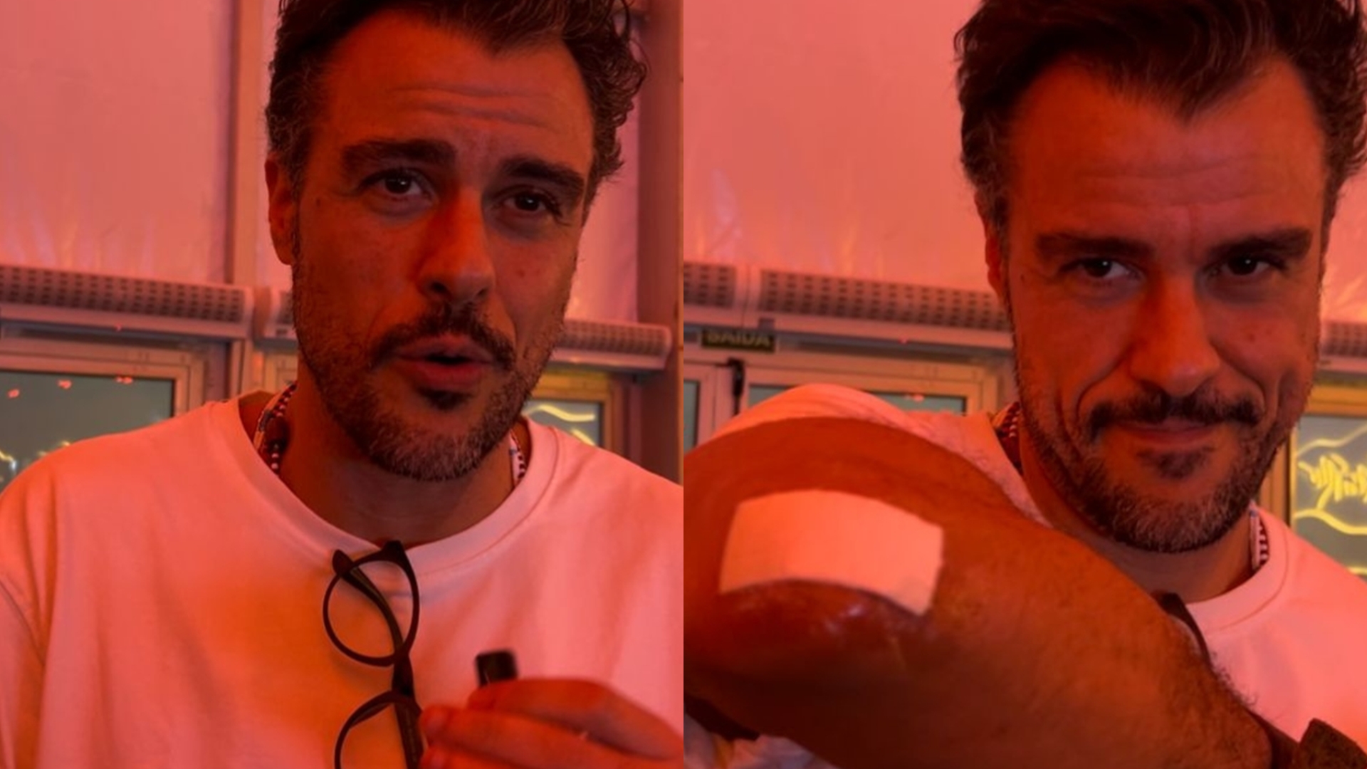 Joaquim Lopes revela situação do braço após cirurgia às pressas: “Entrou uma bactéria”