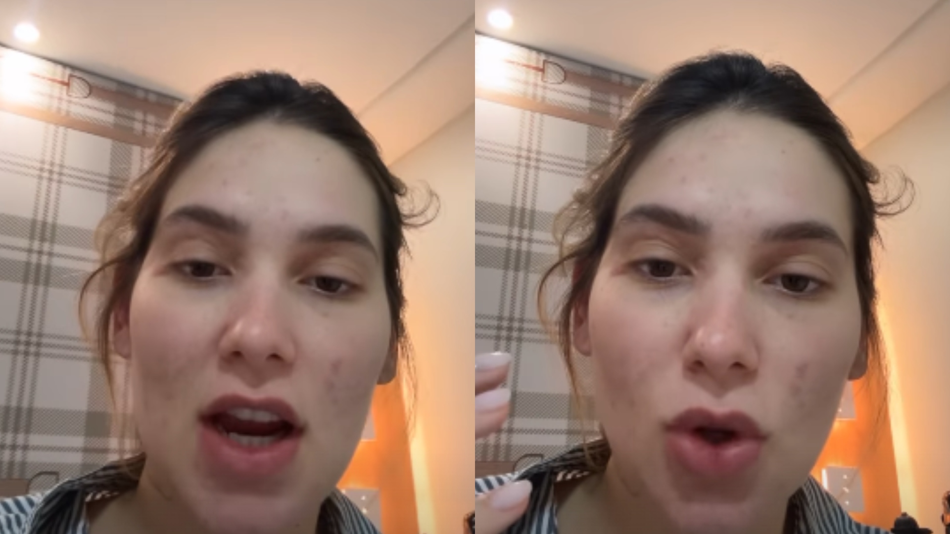 Internada após parto, Virginia recebe diagnóstico e tem reação alérgica: “Inchando”