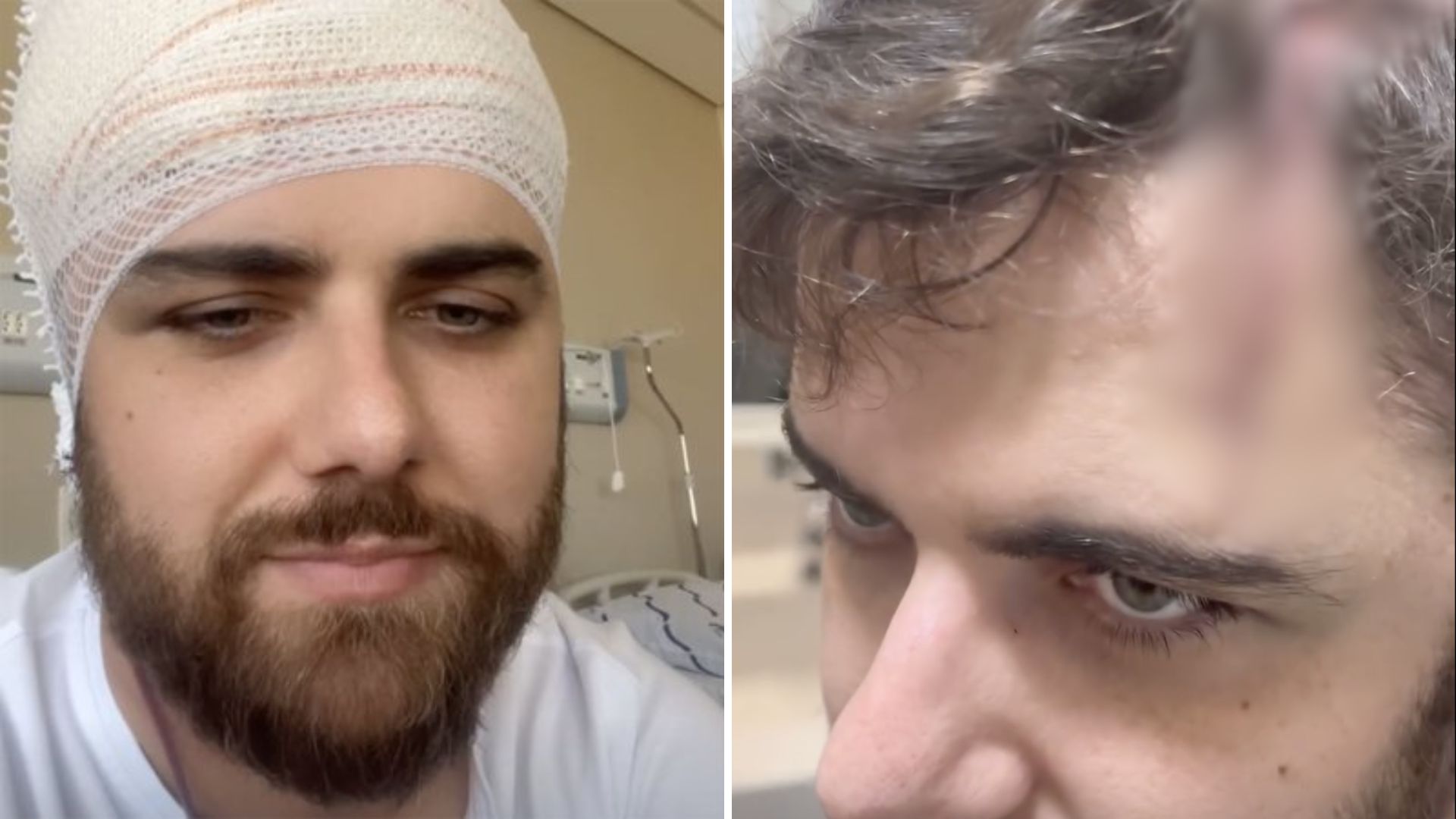 Zé Neto mostra corte na cabeça após acidente grave: “Bem grande”