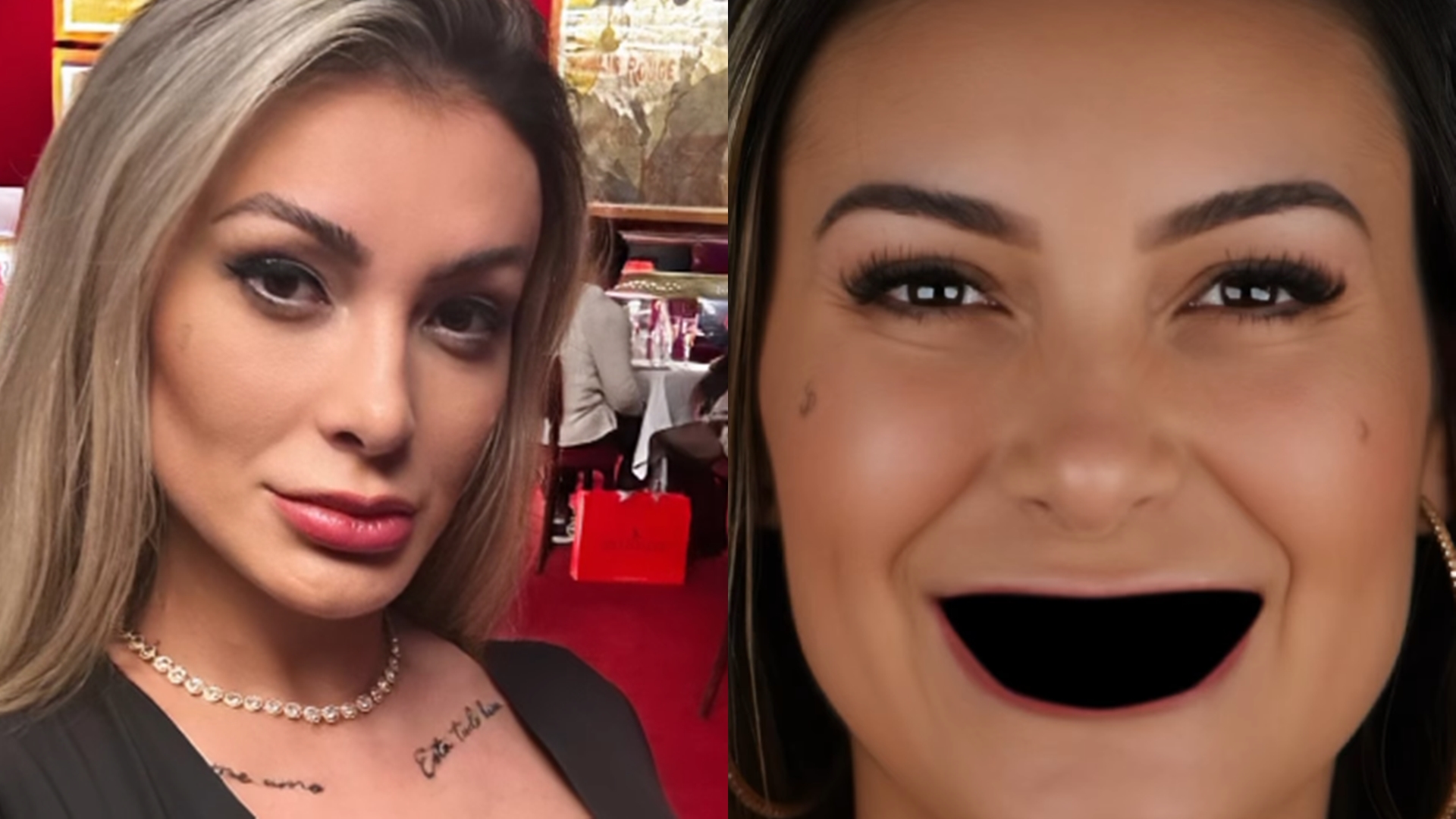 Andressa Urach aparece sem os dentes e espanta fãs: ‘Achei que tinha pintado’