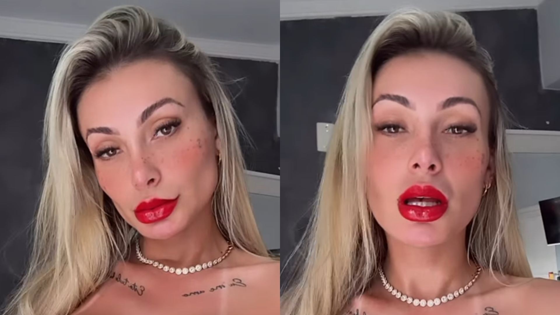 Andressa Urach faz procedimento inacreditável no rosto e fãs reagem: ‘Psiquiatra’