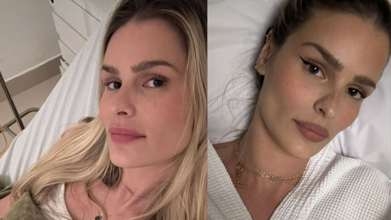 Yasmin Brunet desabafa após onda de ataques: ‘Rosto de caveira’