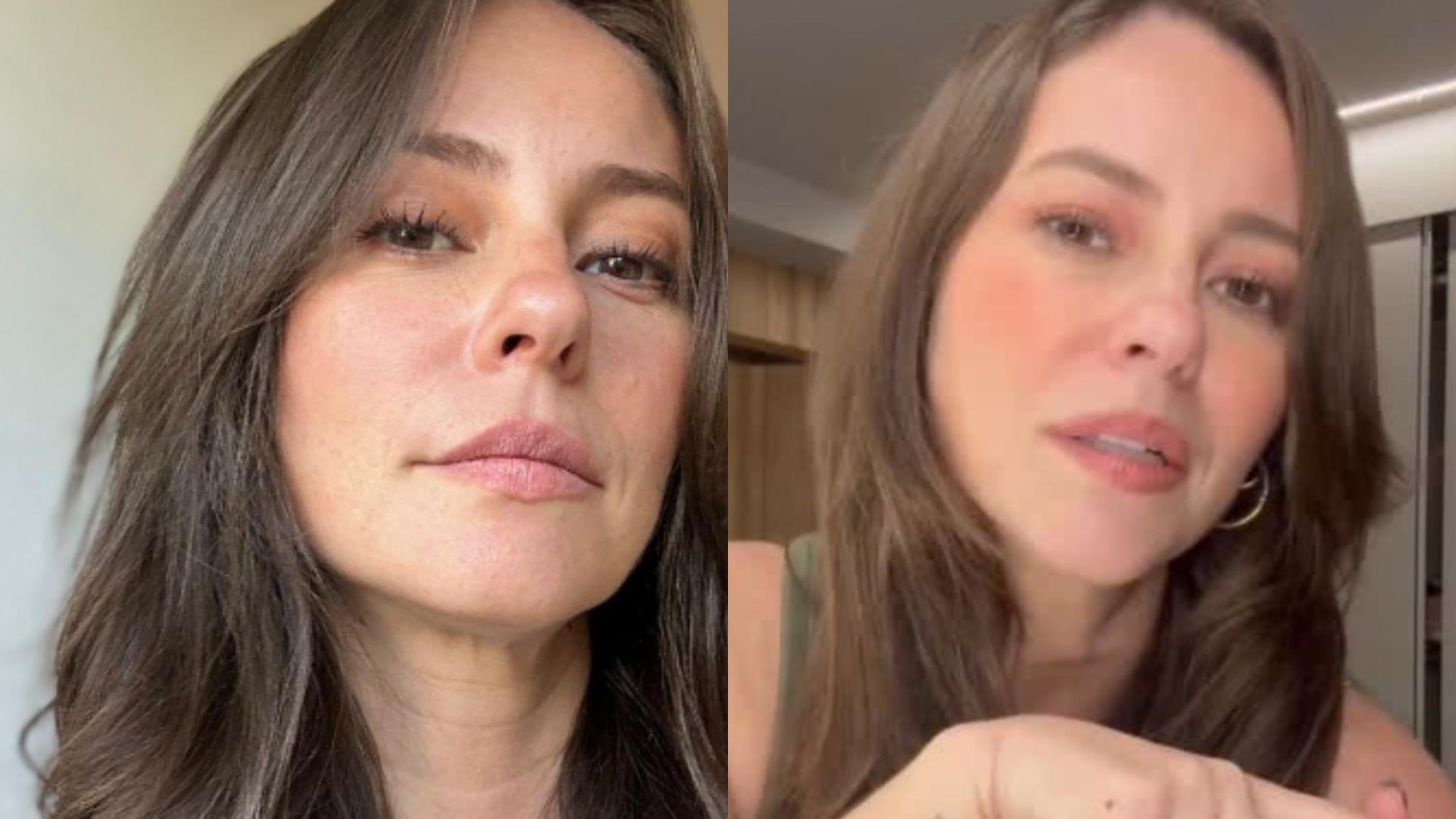 Especialista analisa doença de Paolla Oliveira e relata: ‘Não tem cura’