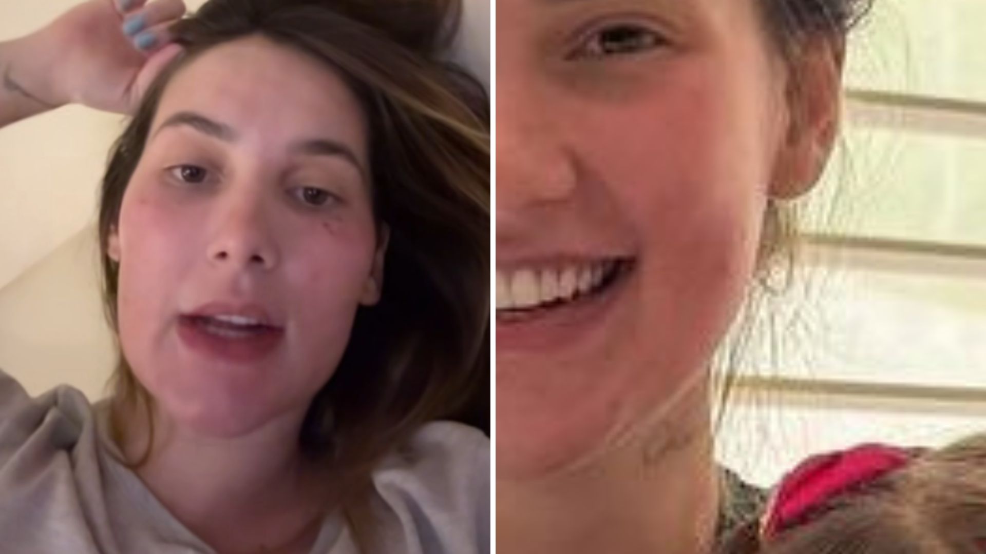 Tá doente? Virginia se explica após aparecer com o rosto ‘deformado’ em fotos
