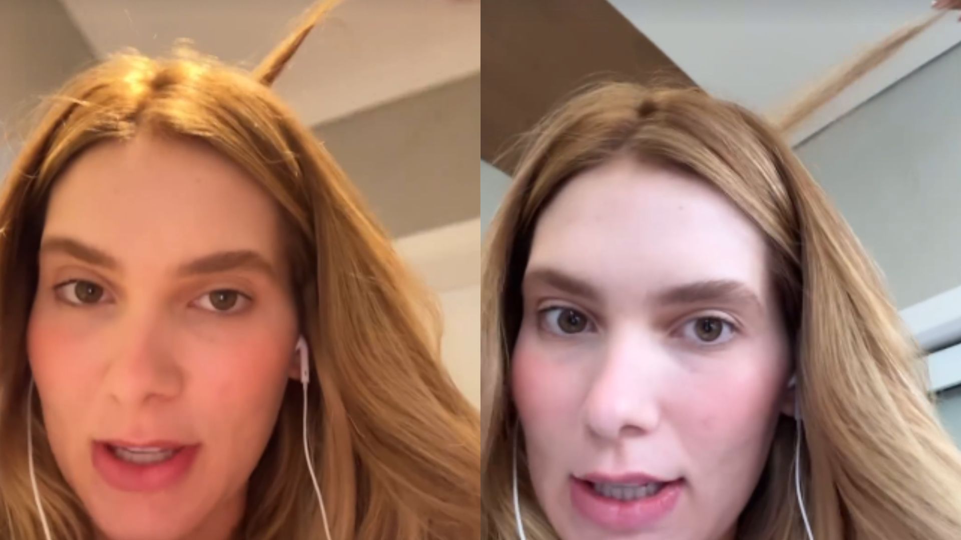 Virginia careca? Influenciadora revela que teve três buracos no cabelo