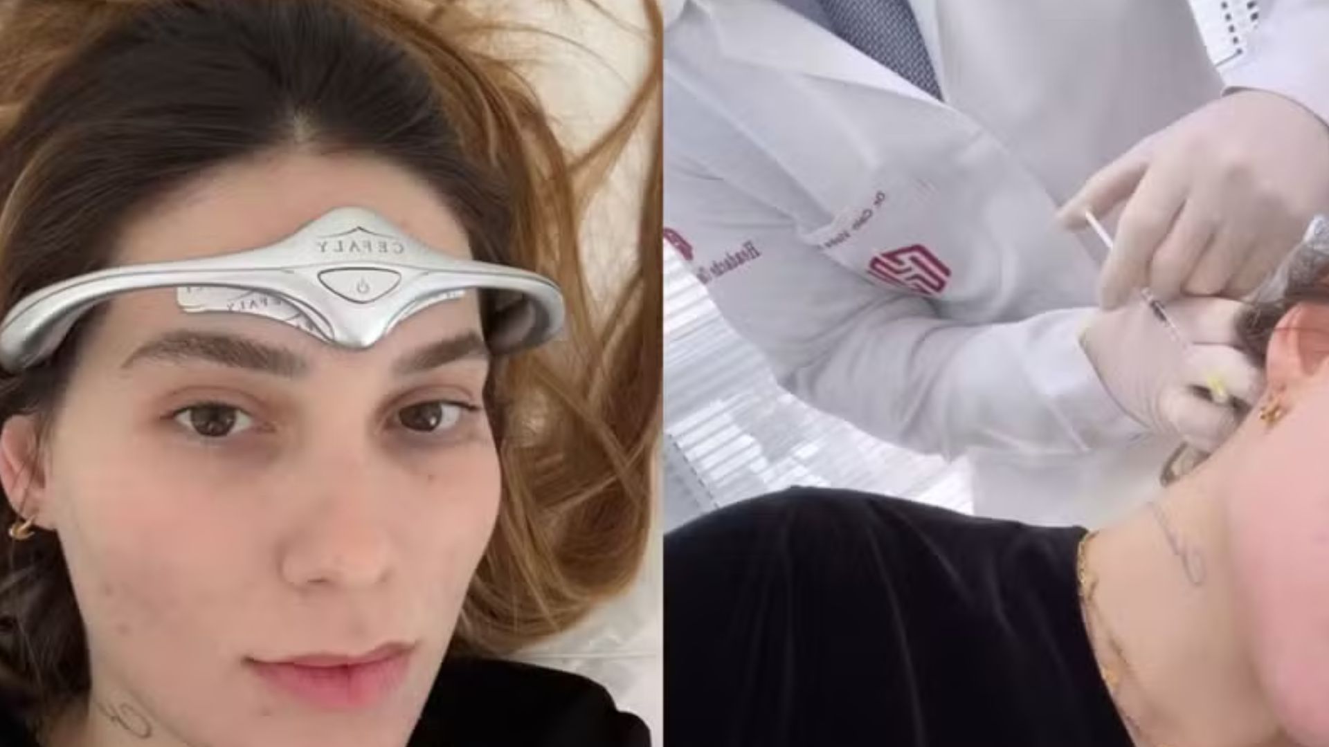 Botox terapêutico: Descubra quanto custa procedimento feito por Virginia