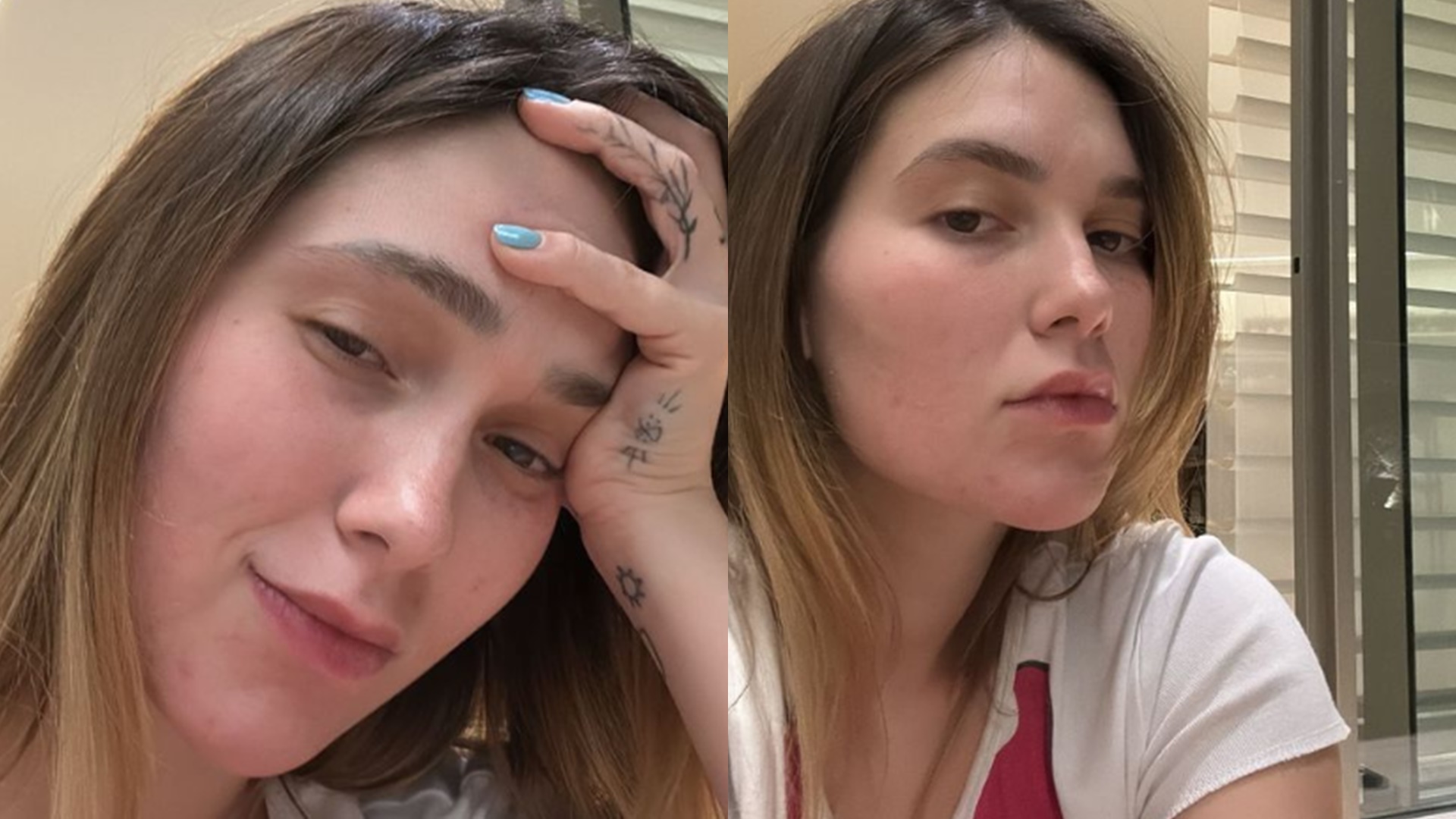 Virginia Fonseca cogita tirar o silicone após problema de saúde: ‘O dia todo dopada’