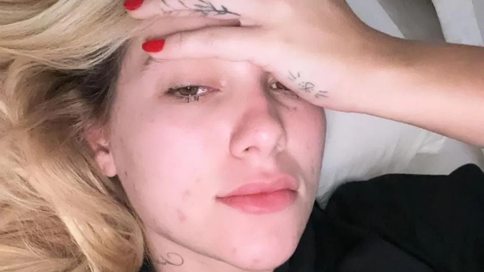 Virginia Fonseca diz que adquiriu doença após problemas com sua maquiagem