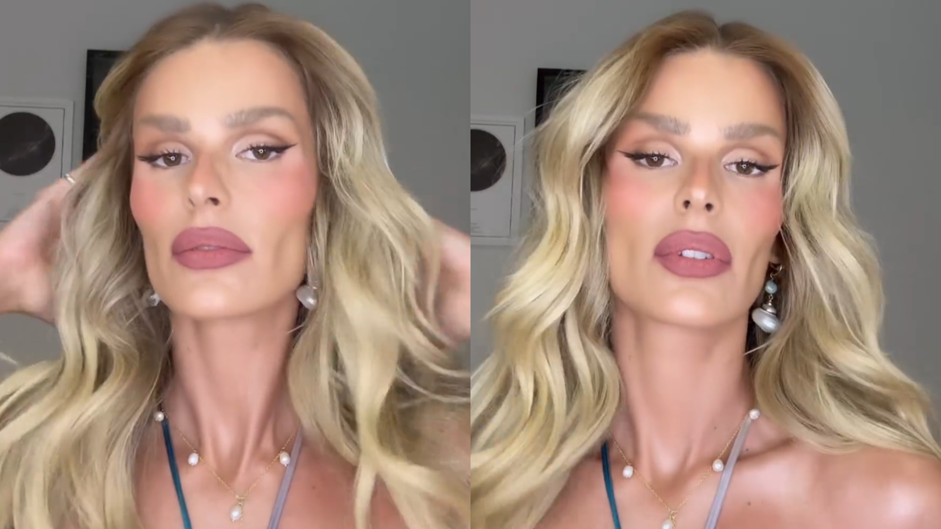 Yasmin Brunet tem aparência detonada e se pronuncia: ‘O que aconteceu com seu rosto’