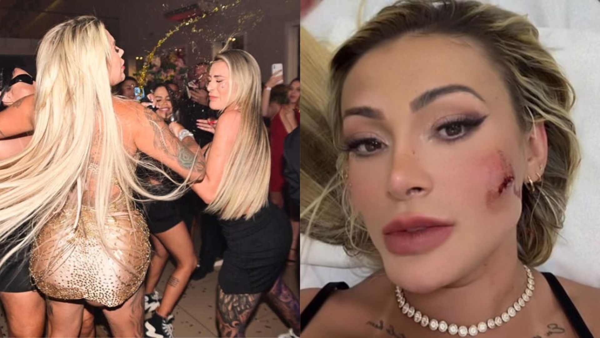 Andressa Urach choca ao revelar verdadeiro motivo de não fazer B.O. contra Juju Ferrari