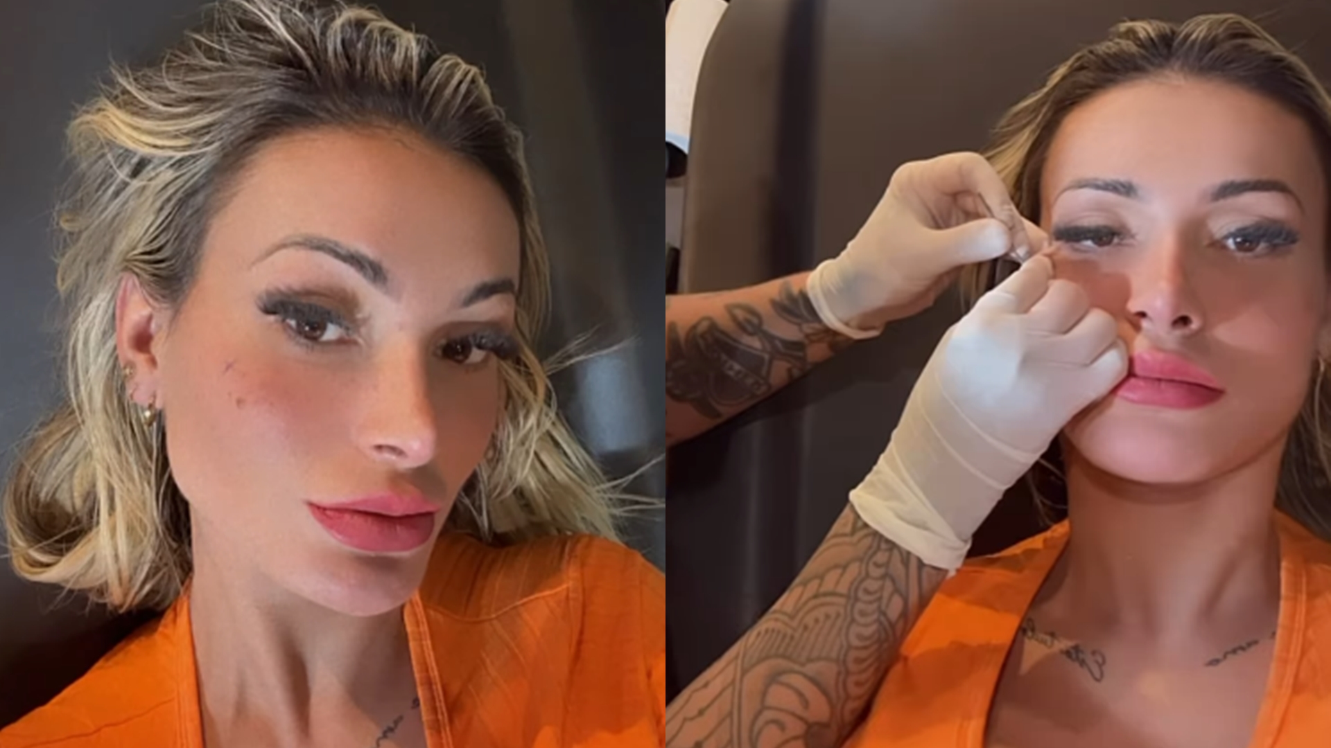 Andressa Urach modifica o rosto de novo após tatuar sardas e preocupa os fãs: ‘Chocada’