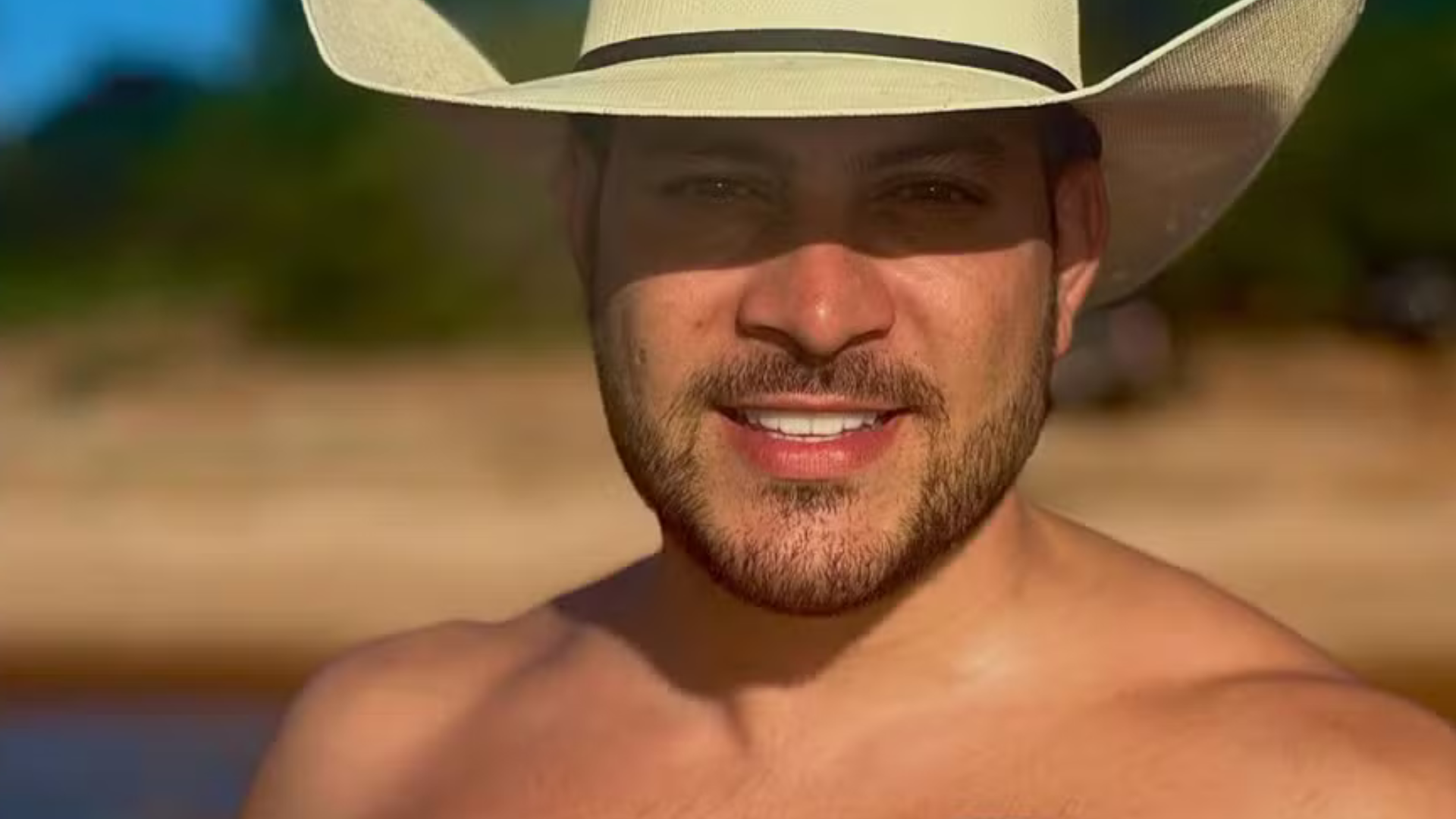 Ex-BBB Caio Afiune fala sobre cirurgia para diminuir as mamas: ‘Me incomodava’