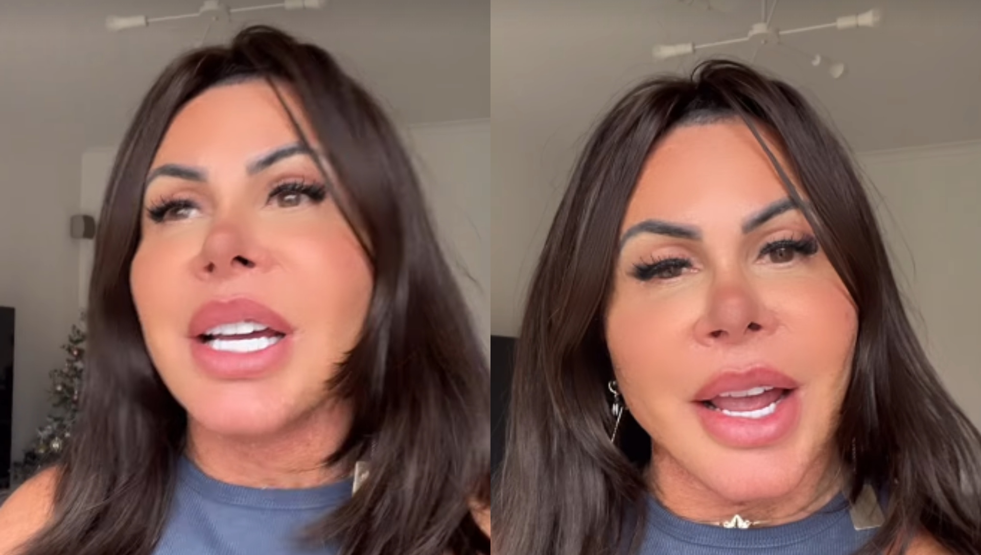 Gretchen rebate críticas após novo procedimento estético: ‘Não tem jeito’