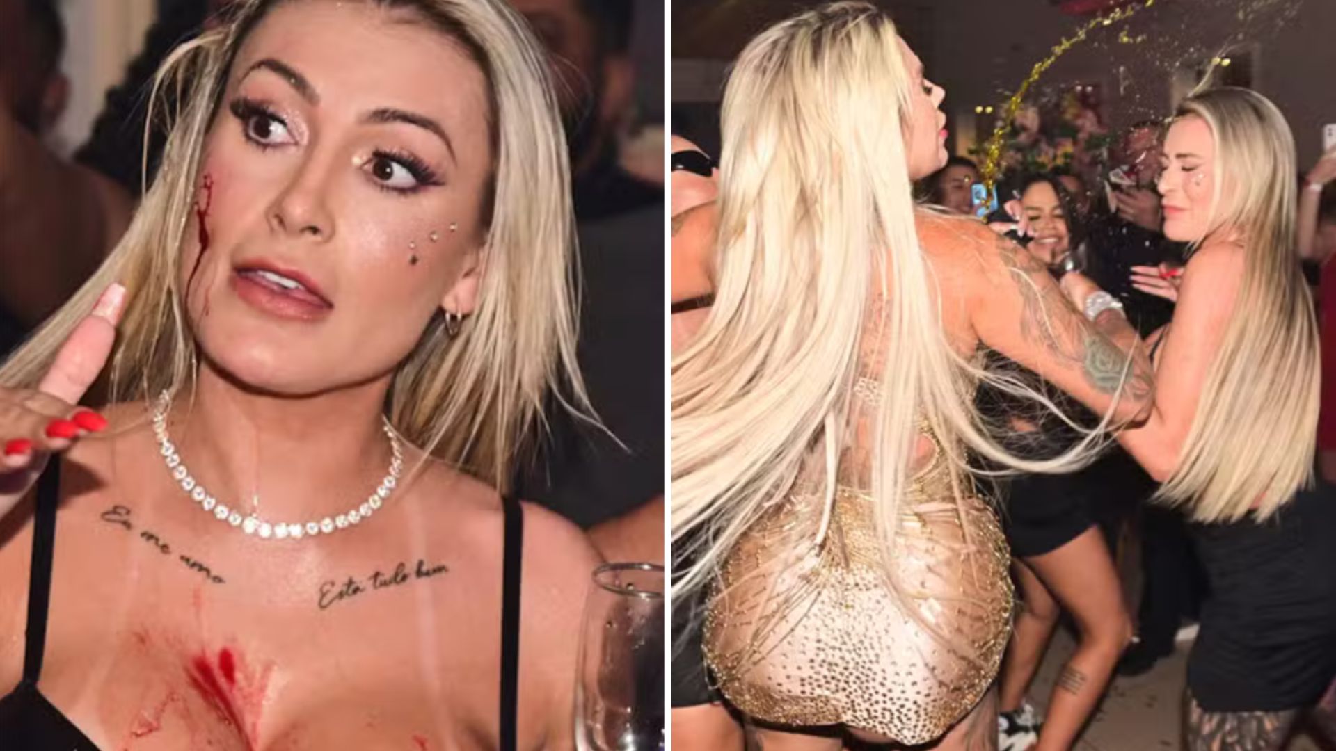 Por que Andressa Urach e Juju Ferrari saíram na mão? Modelo foi parar no hospital