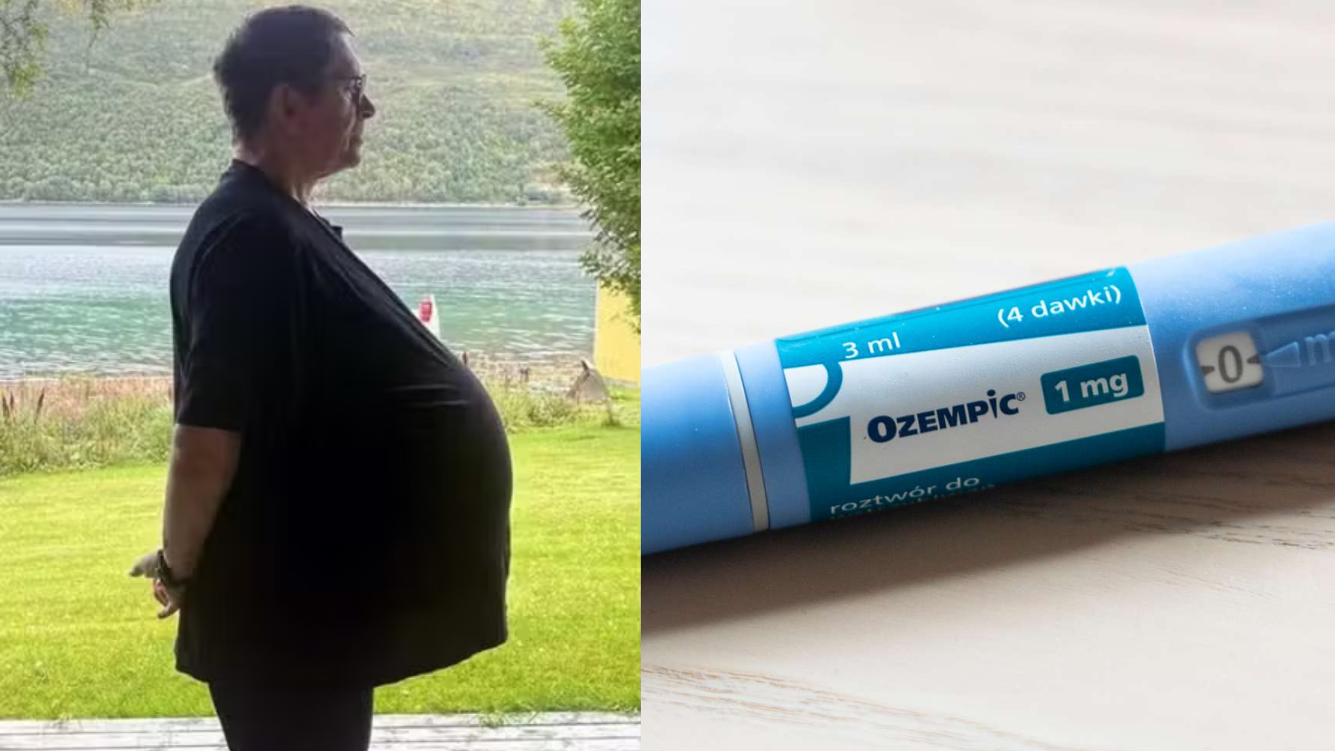 Médico descobre que ‘obeso’ tratado com Ozempic tinha na verdade um tumor de 27kg