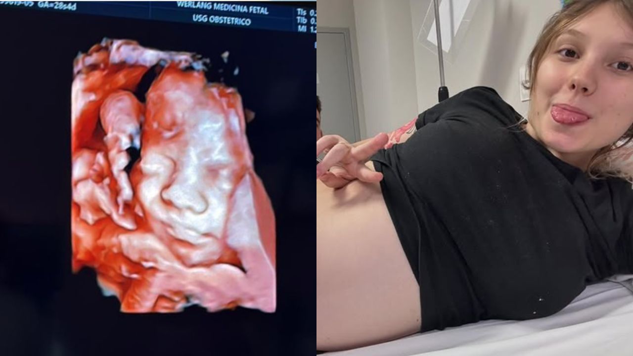 Isabel Veloso se derrete com ultrassom do filho: ‘Lindo demais’