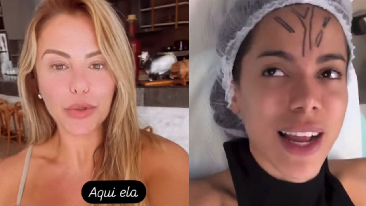 Poliana Rocha revela procedimento de tirar veia da testa: ‘Dou razão pra Anitta’