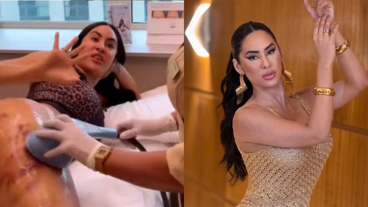 Isabelle Nogueira fala de procedimento anticelulite e mostra resultado: ‘Clareou’