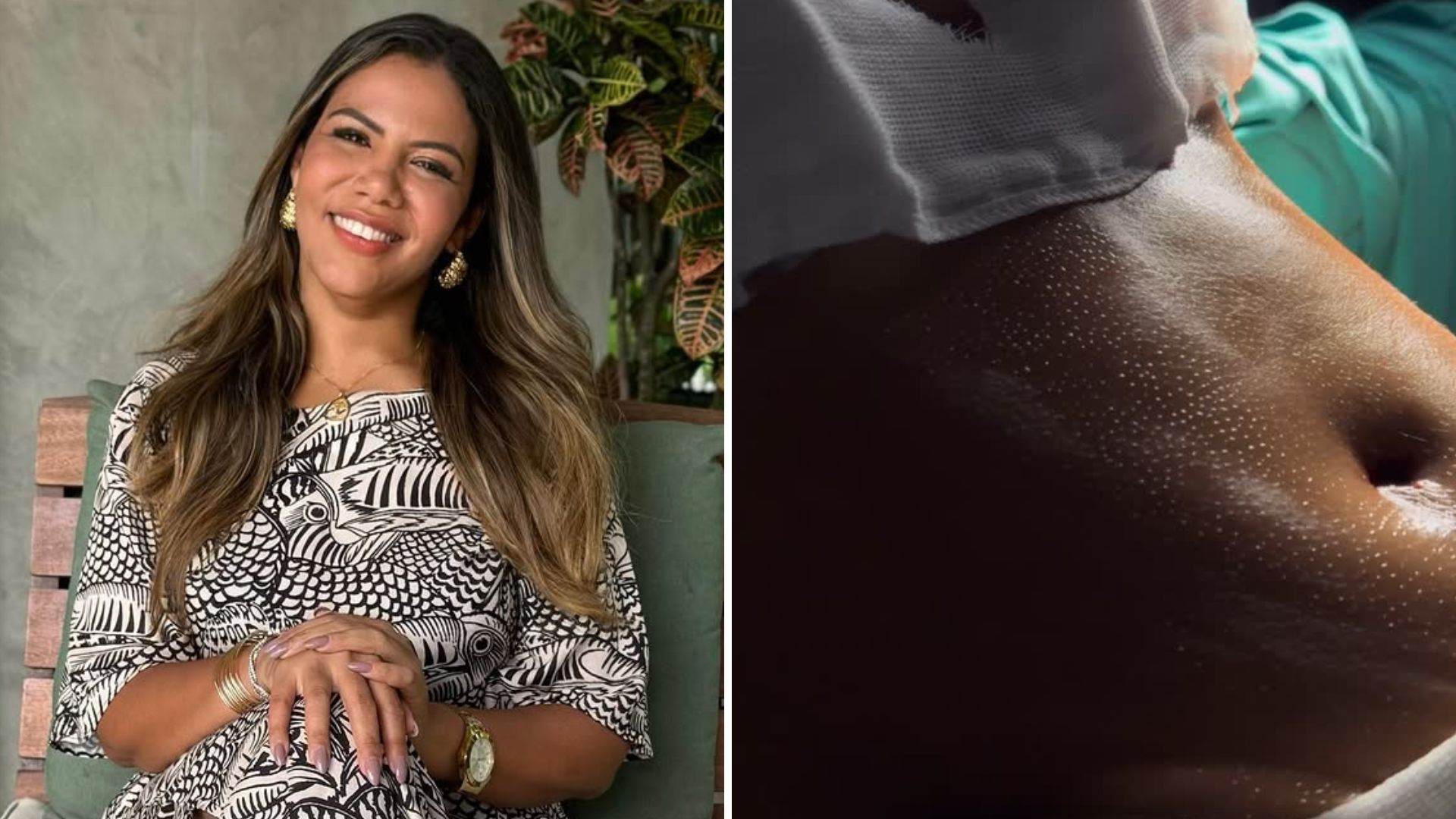 Mani Reggo revela transformação após cirurgias plásticas: veja o resultado