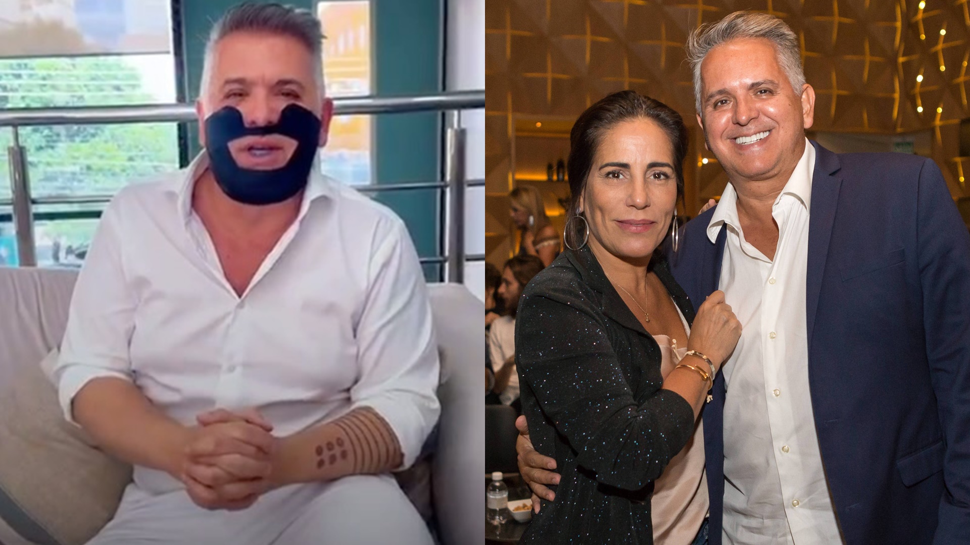 Marido de Gloria Pires atualiza estado de saúde após cirurgia delicada: ‘Tem mais uma’