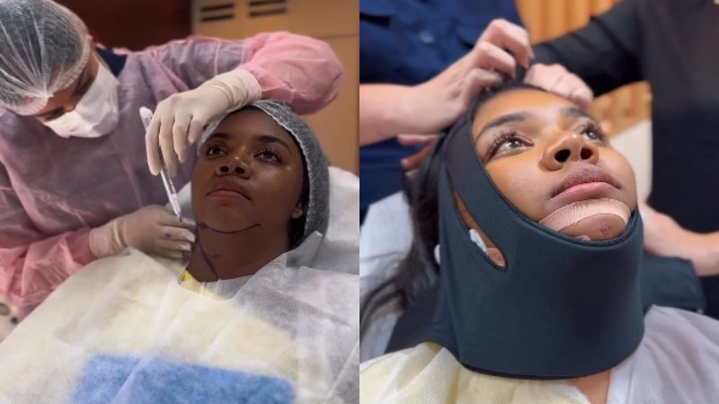 Mudança drástica! Após lipo, Raquel Brito revela planos de procedimento estético