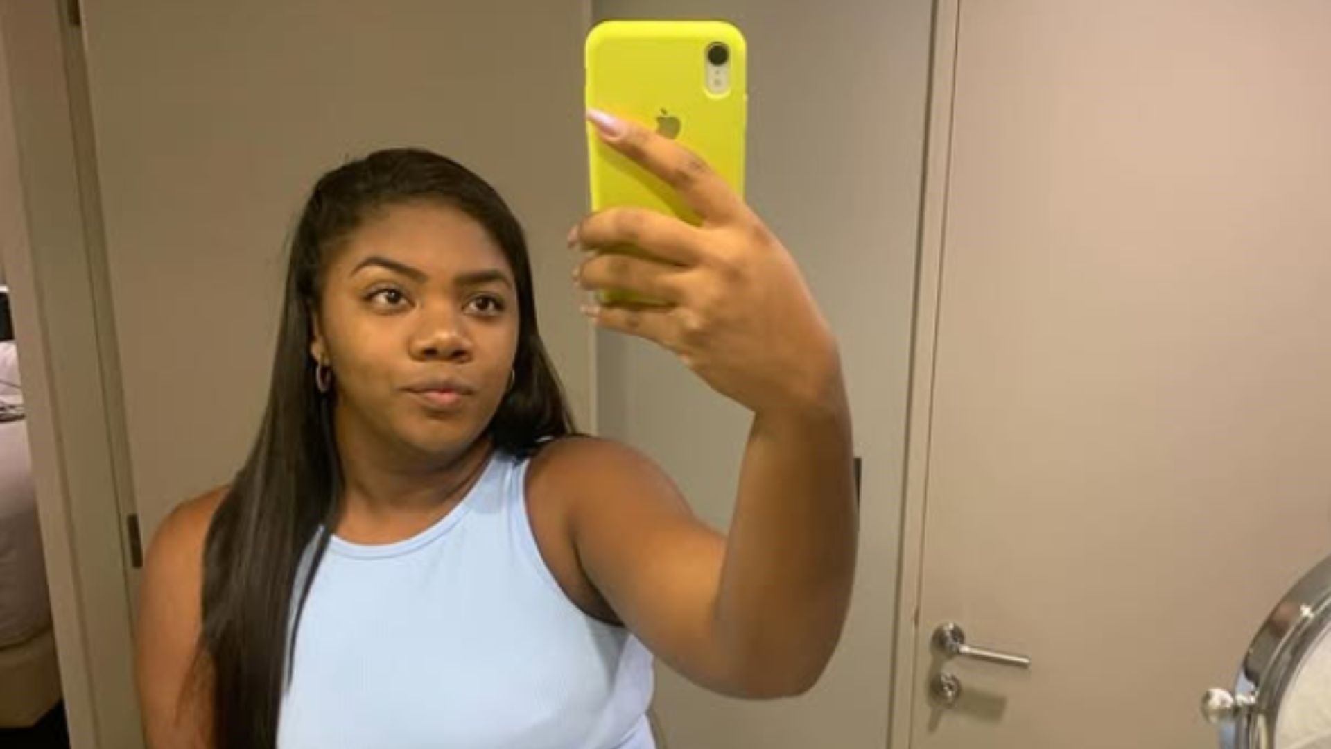 Raquel Brito surpreende em foto e revela procedimento: ‘Resultado está babado’