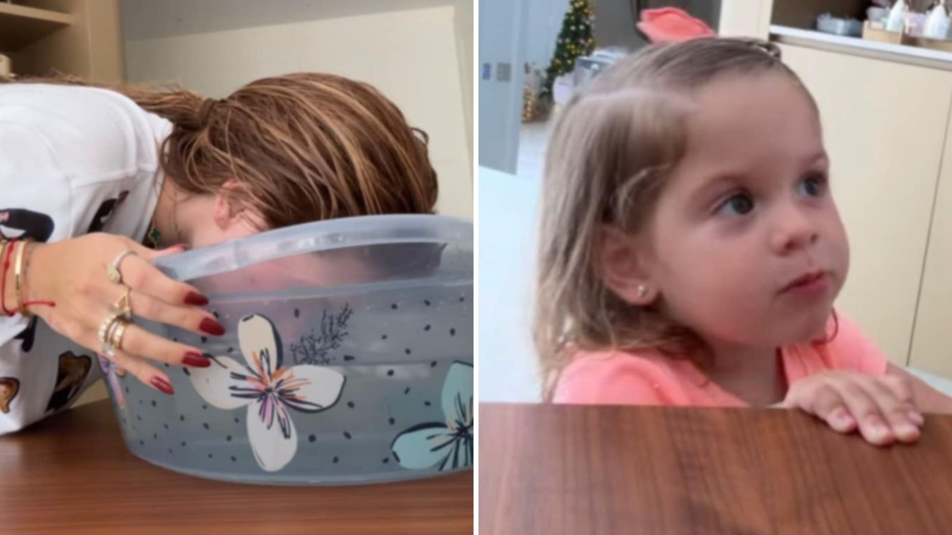 Virginia assusta a filha ao surgir ‘deformada’ após procedimento: ‘Mamãe biruta’