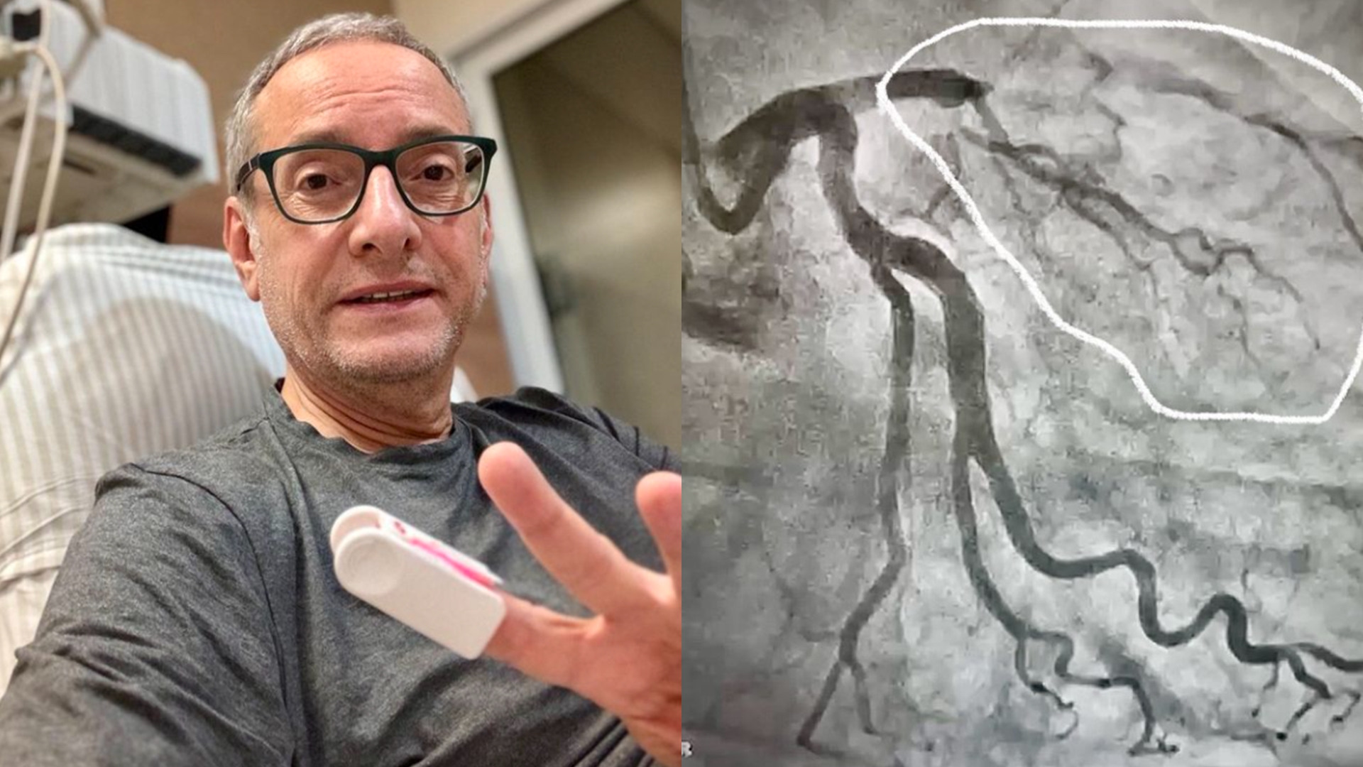 José Roberto Burnier revela o que salvou sua vida após infarto: “Escapei”