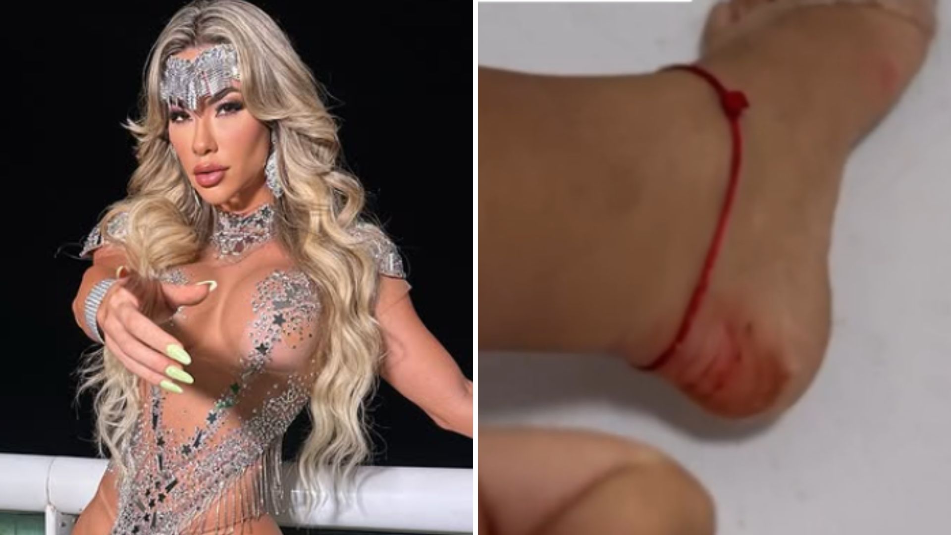Acha que é fácil? Musa samba até o pé sangrar em ensaio de Carnaval: ‘Tudo tranquilo’