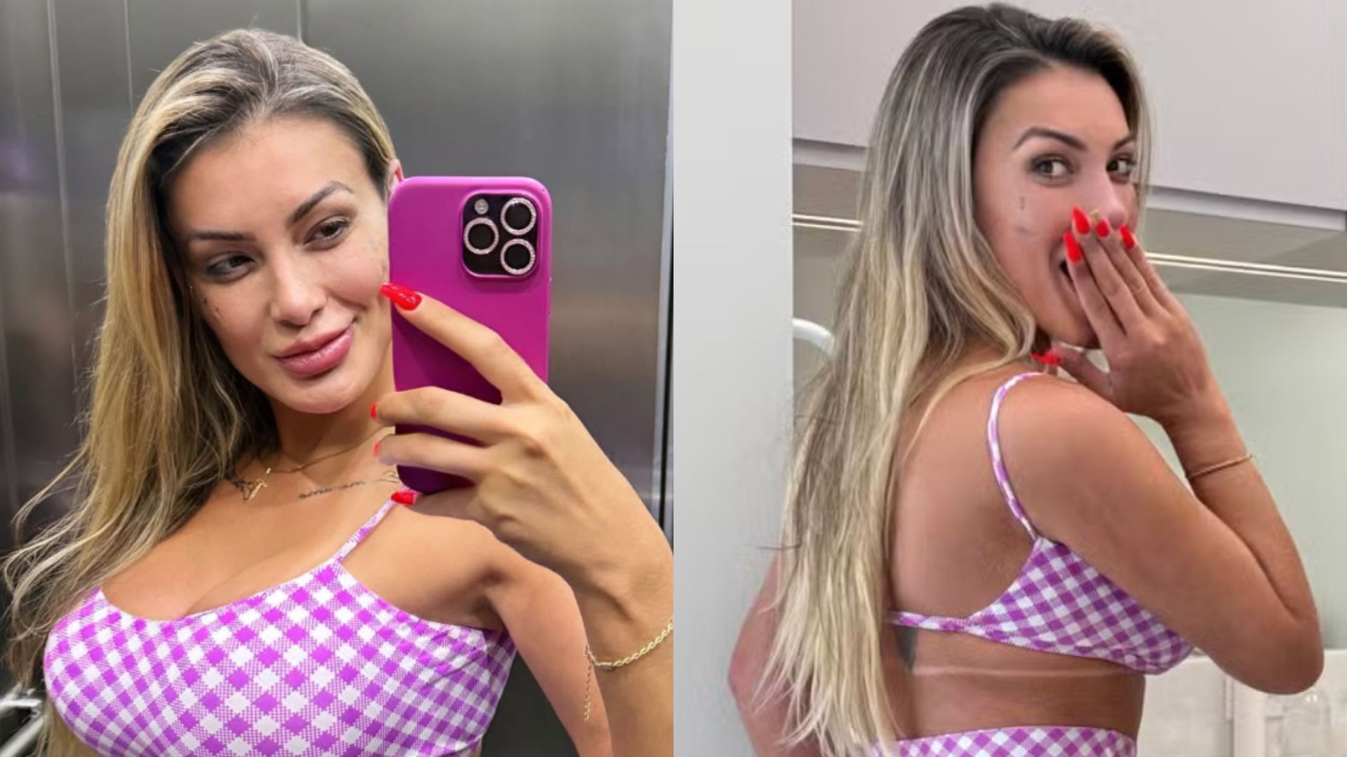Gente? Andressa Urach surpreende com procedimento para aumentar ponto G