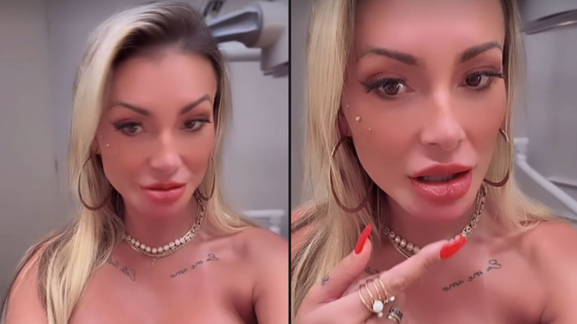 Andressa Urach aparece com a boca enorme e sem conseguir falar direito: ‘Delicado’