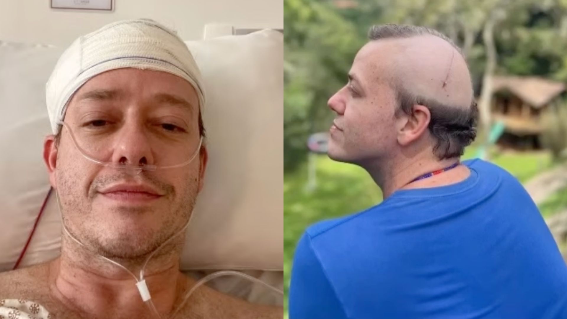 Pablo Sanábio celebra recuperação de tumor cerebral: ‘Por favor, cuidem-se’