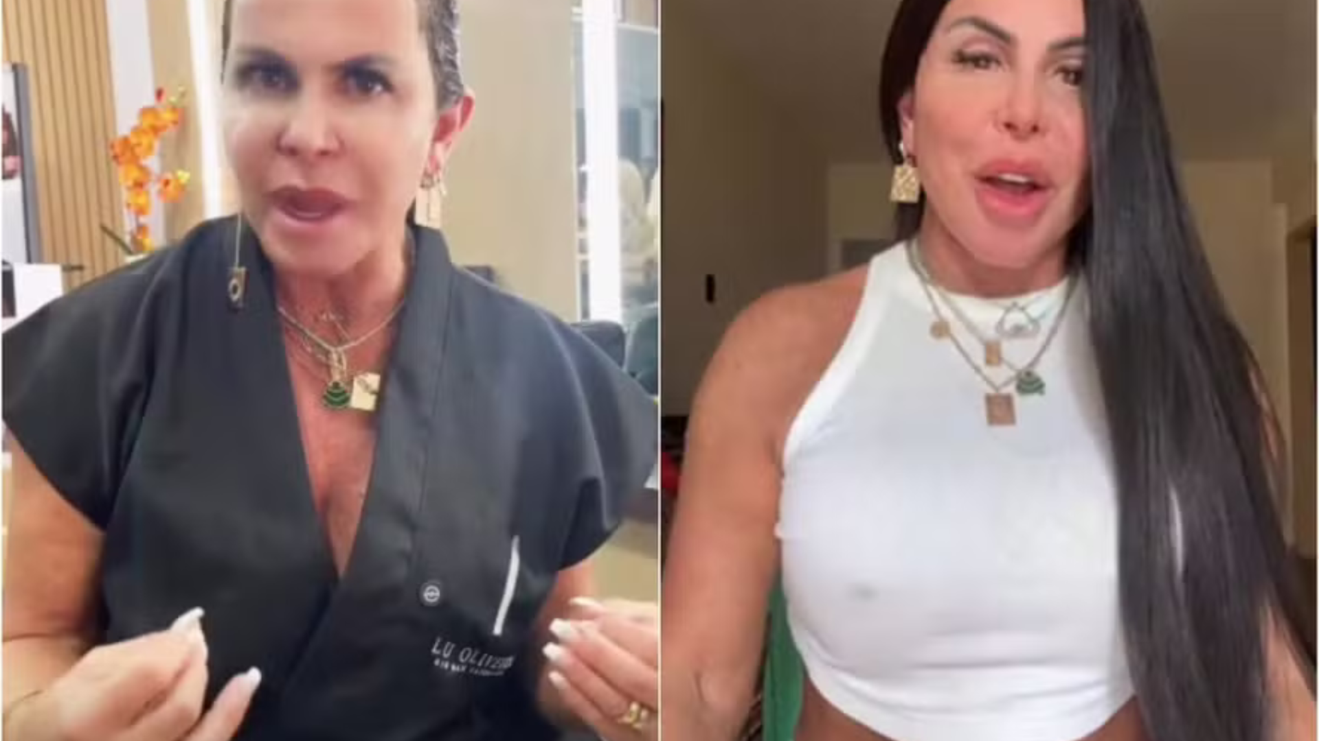 Com alopecia, Gretchen aparece sem mega hair: ‘Faço questão que vejam a realidade’