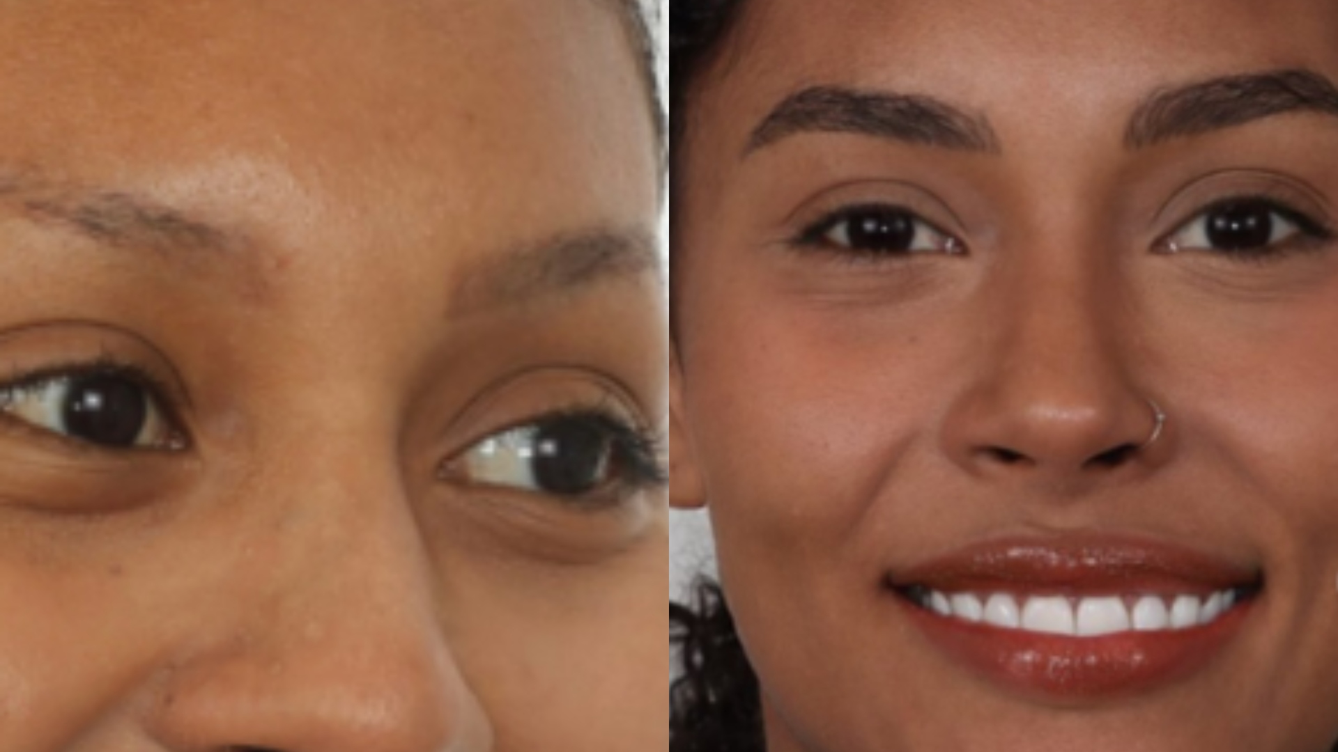 Médica expõe procedimentos estéticos de Giovanna Jacobina; antes e depois impressiona