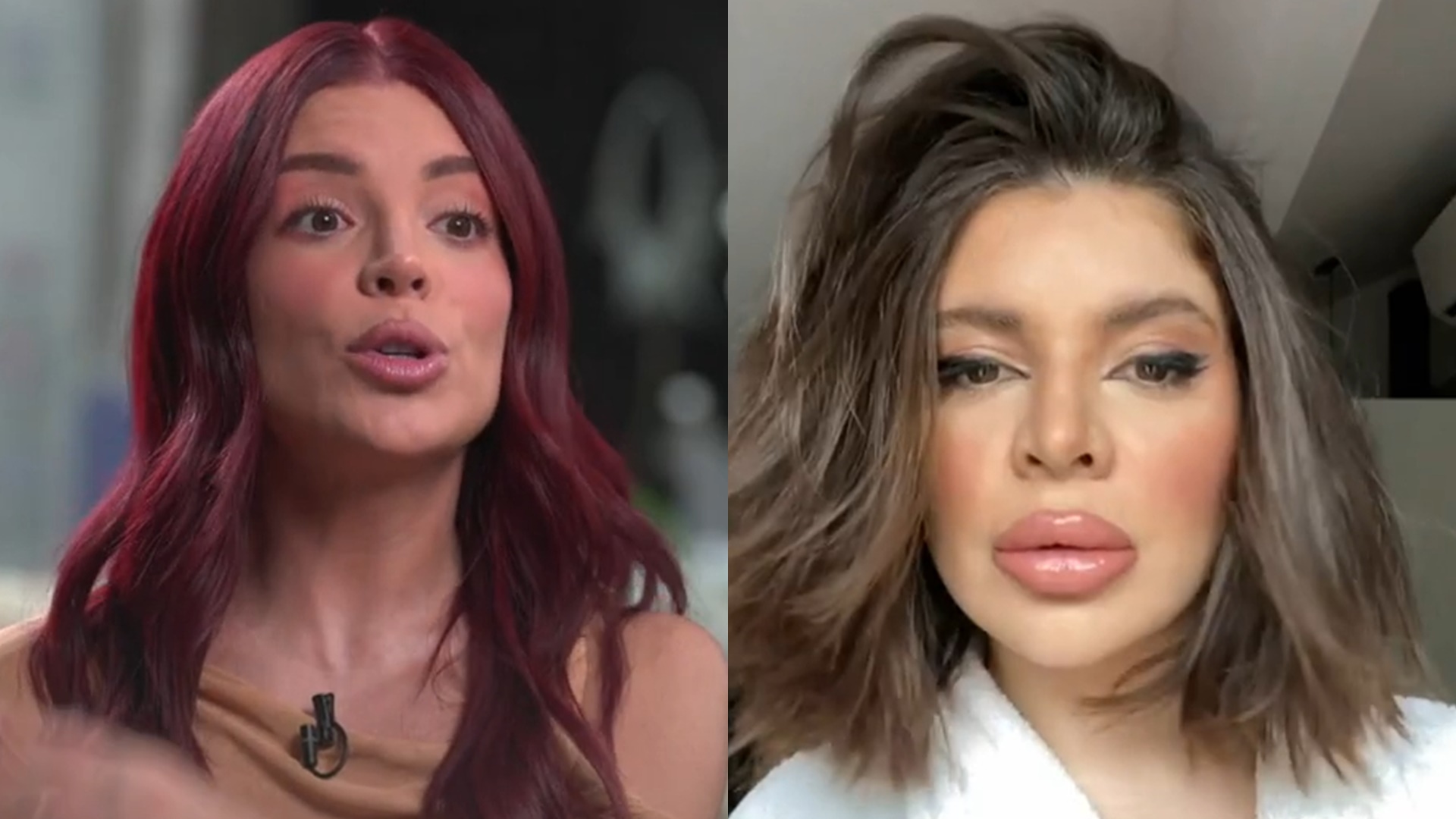 Gkay assume vício em harmonização facial e volta atrás: ‘Quero ficar totalmente sem’