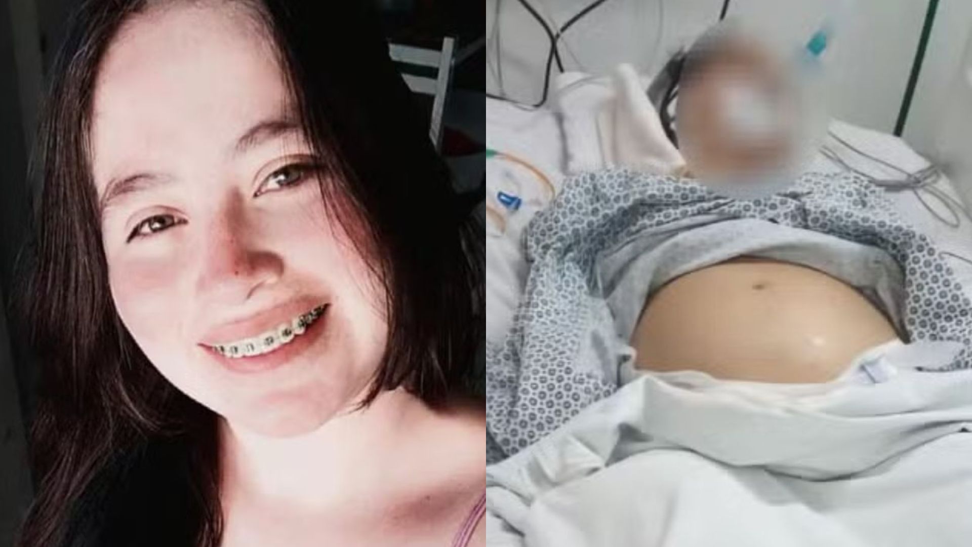 Grávida com morte cerebral é mantida viva por aparelhos para salvar o filho